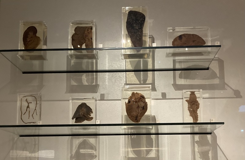 Organs from 1900-1950 in a Science Museum, UK exhibit. Clones in&nbsp;Never Let Me Go&nbsp;donated their organs.